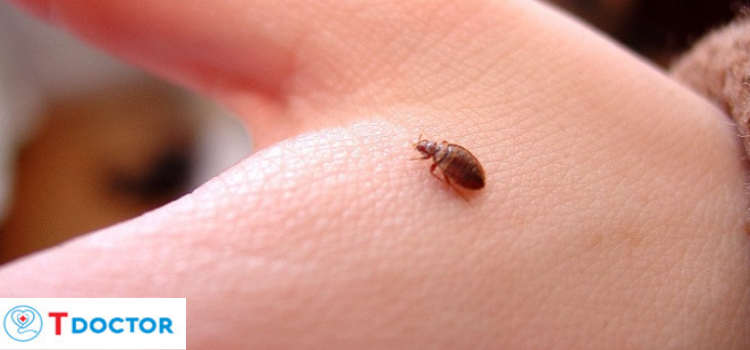 Rận mèo cắn người có sao không? Và những giải pháp hữu hiệu