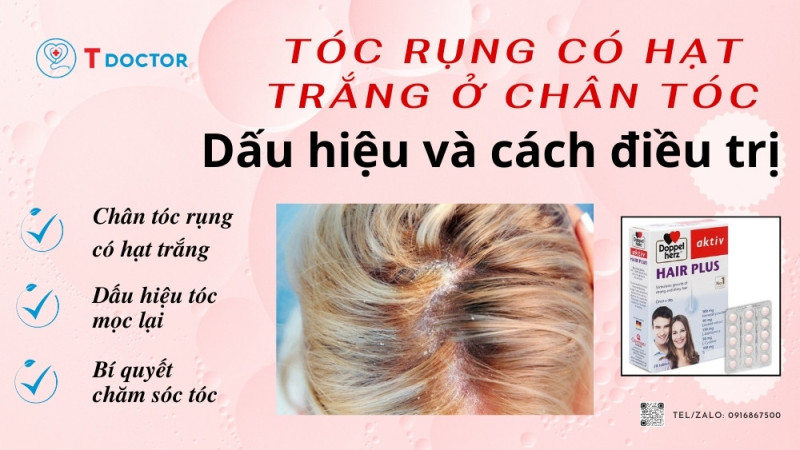 Tóc rụng là một vấn đề phổ biến mà nhiều người gặp phải, đặc biệt là ở phụ nữ. Một trong những dấu hiệu của tóc rụng là khi chân tóc bị rụng có hạt trắng. Điều này thường gây lo lắng và bất an cho người bị tóc rụng. Trong bài viết này, chúng ta sẽ tìm hiểu về tóc rụng có hạt trắng ở chân tóc, dấu hiệu và cách điều trị.