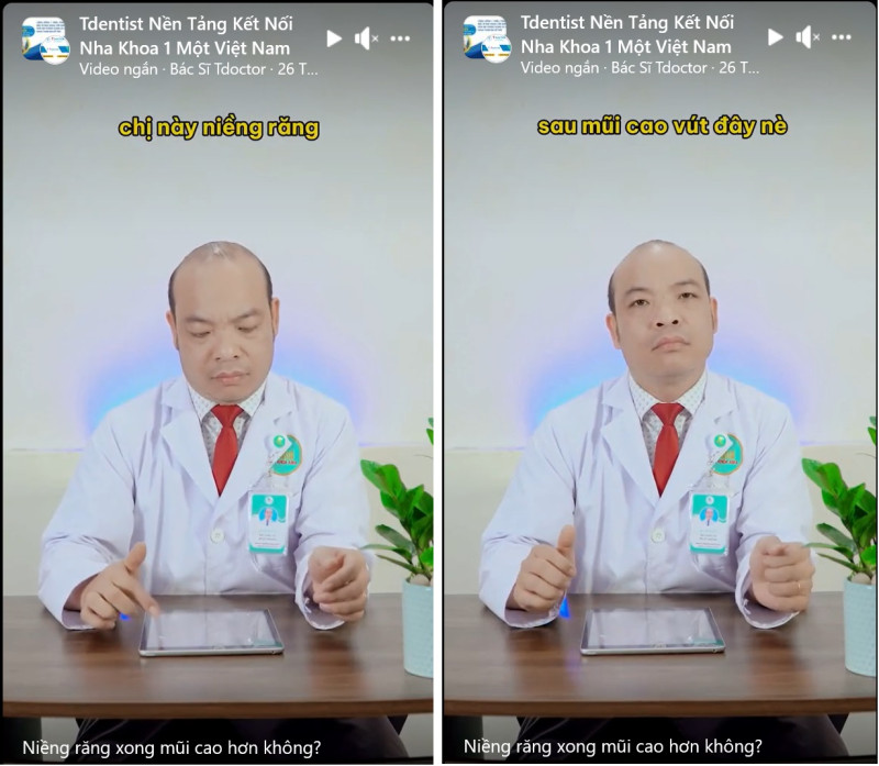 Niềng răng mũi cao lên? Hãy nghe tư vấn của bác sĩ nha khoa Asia đối tác của Tdentist 