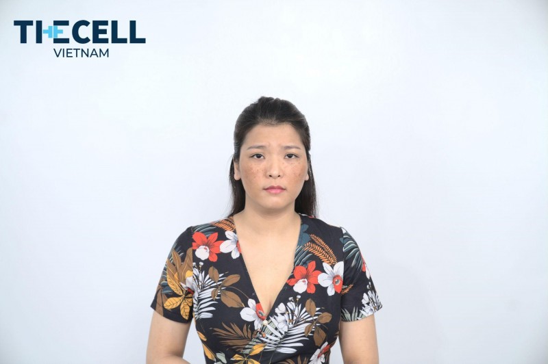 Nám mặt cỡ nào cũng hết nhờ công nghệ nám Max Cell